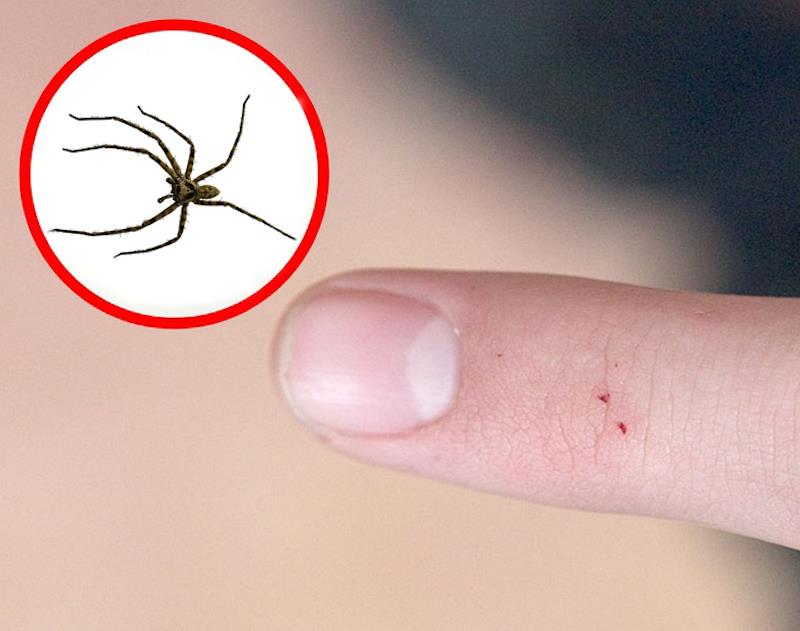 voro įkandimo patinimas ant piršto